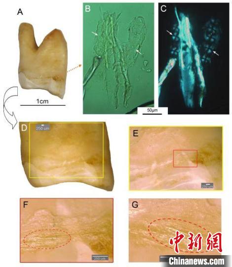 湖南道縣福巖洞8-12萬年前古人類剔牙行為的遺存痕跡?！清?供圖